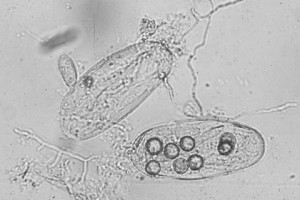 Fig 4 Nematode eggs/cyst parasitized by fungi