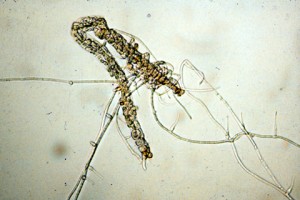 Fig 3 Nematode spp trapped by Fungi